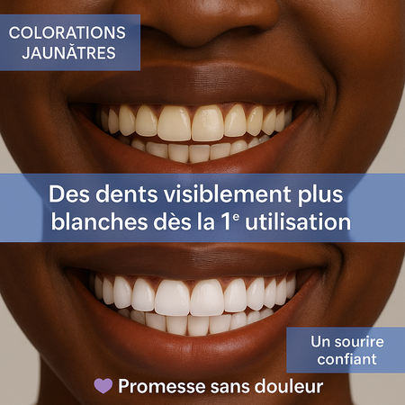 Sérum Correcteur de Teinte pour les Dents – Effet instantané, sans peroxyde, sourire plus net - ZENDO COREAN SKINCARE