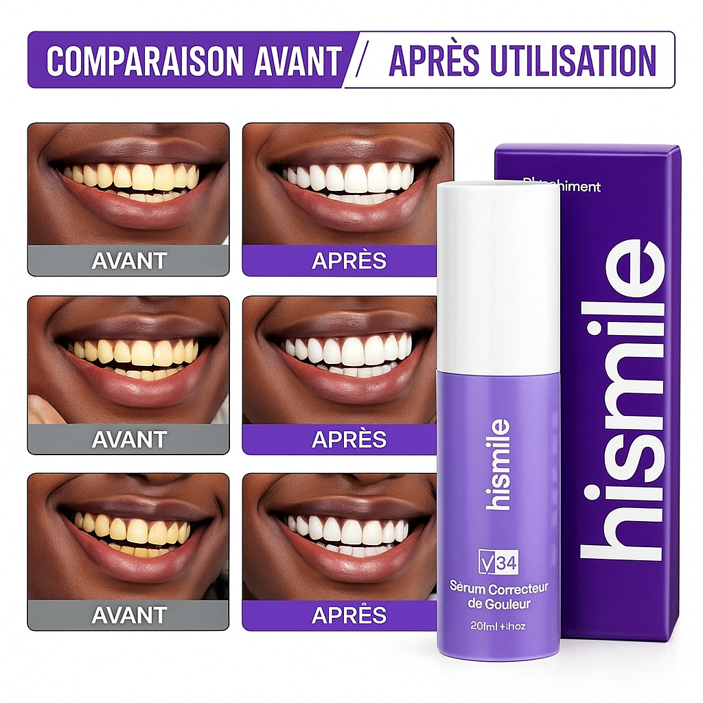 Hismile™ – Le Sérum Qui Illumine Ton Sourire Sans Agression - ZENDO COREAN SKINCARE